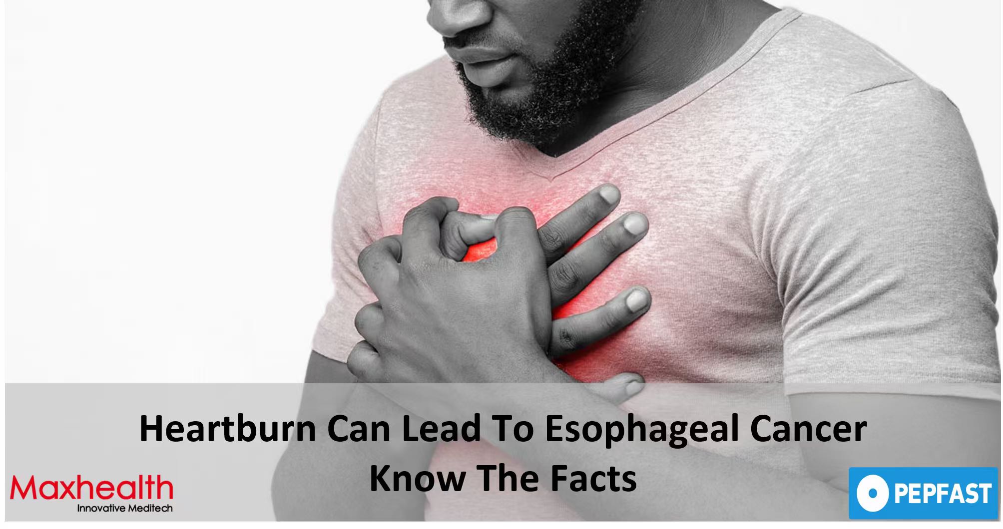 الرابط الحاسم بين الارتجاع المعدي المريئي وسرطان المريء، ومسار جديد نحو الوضوح